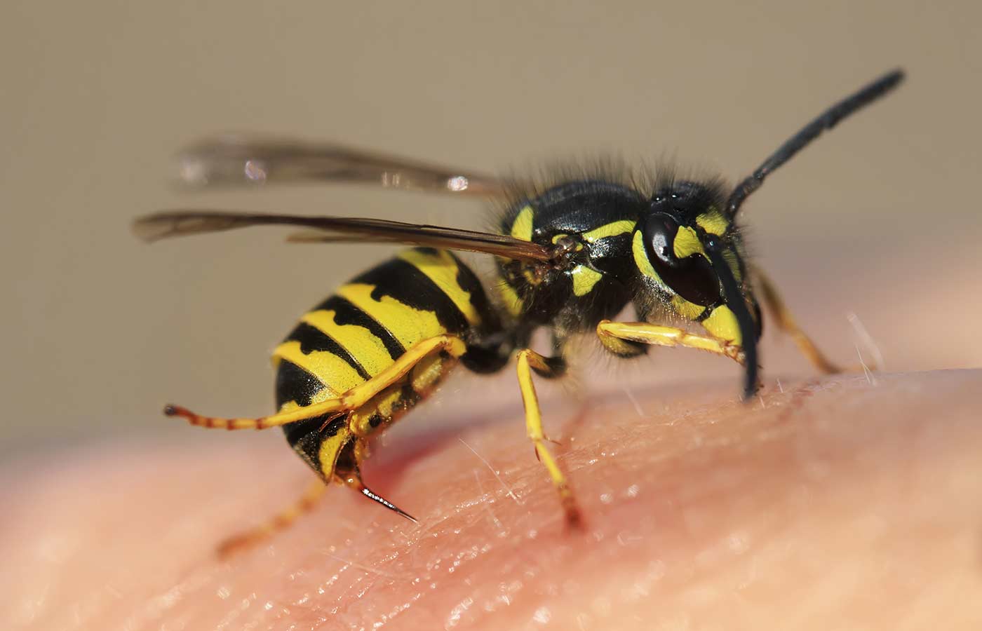 wasp stinging skin